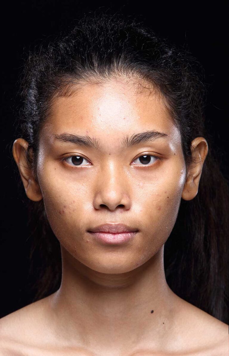 face-before